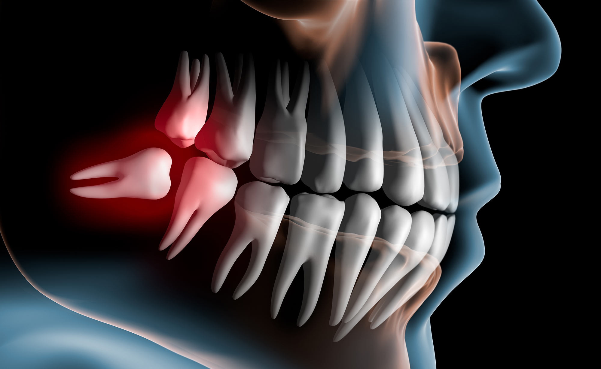 Oralchirurgie bei MunichDent in München