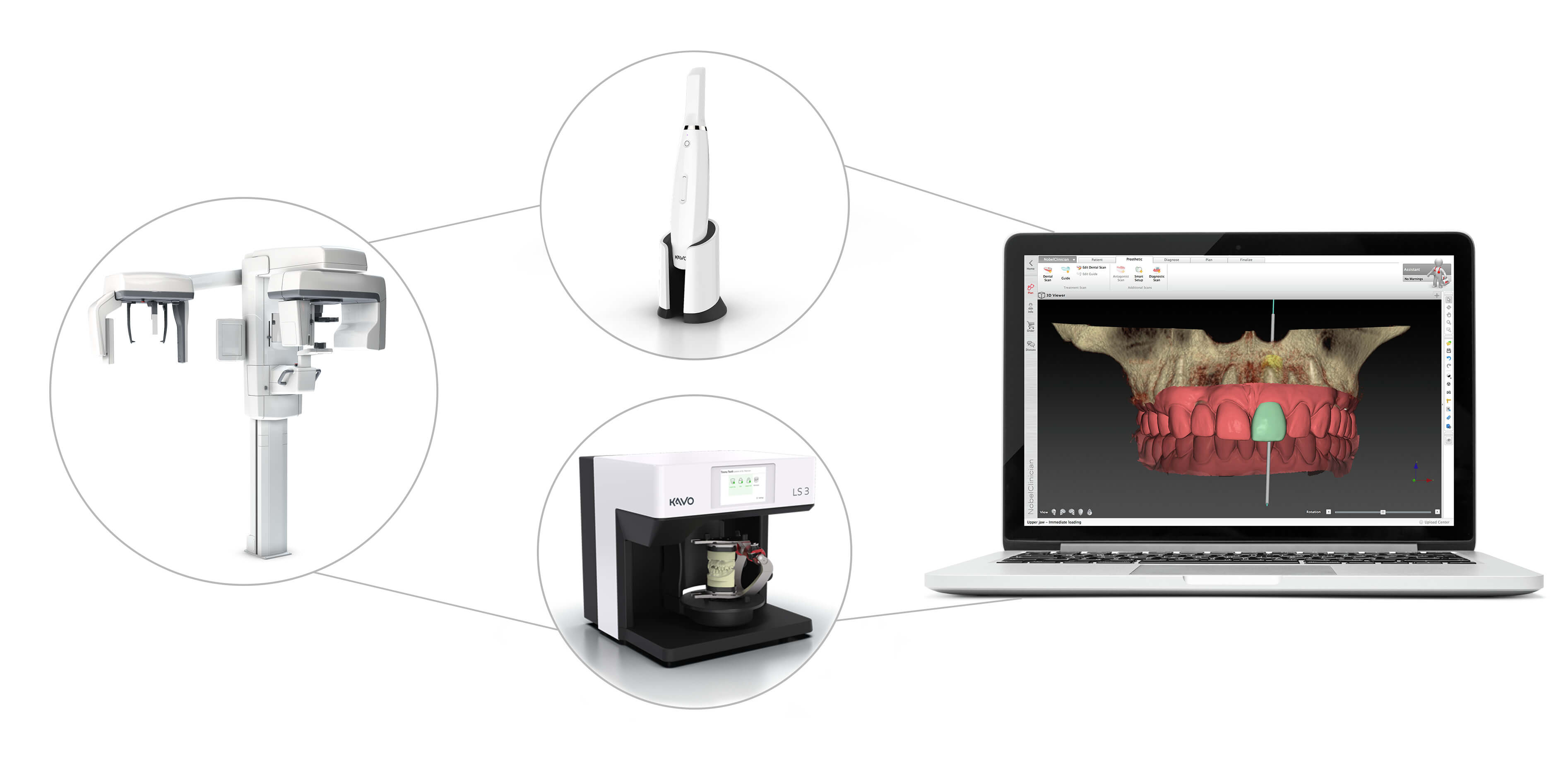 3D - Röntgendiagnostik in München bei MunichDent